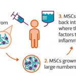 اولین نتایج آزمایش جدید درمان با سلول های بنیادی msct اعلام شد