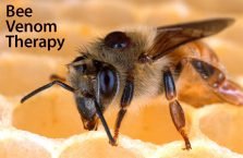 زنبور درمانی و ام اس