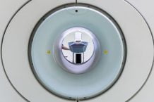 تکنیک های پیشرفته MRI ممکن است سرنخی درمورد پیشرفت ام اس را ارائه دهند